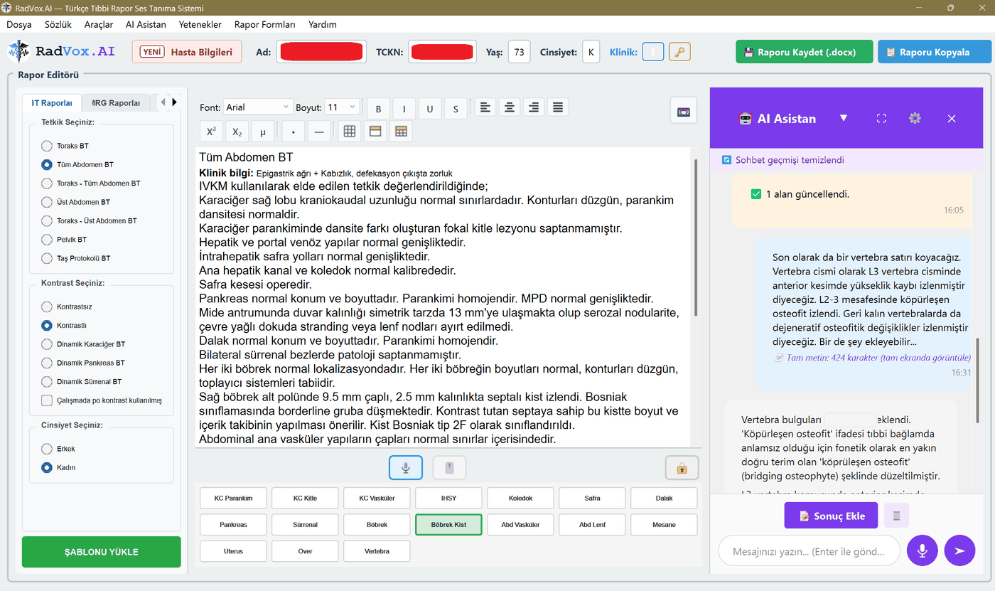 RadVox.AI rapor editörü: solda hızlı rapor giriş formları, ortada rapor editörü ve dikte, sağda AI asistan